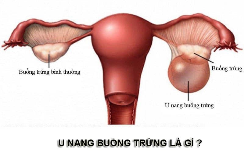 unang-buong-trung-la-gi